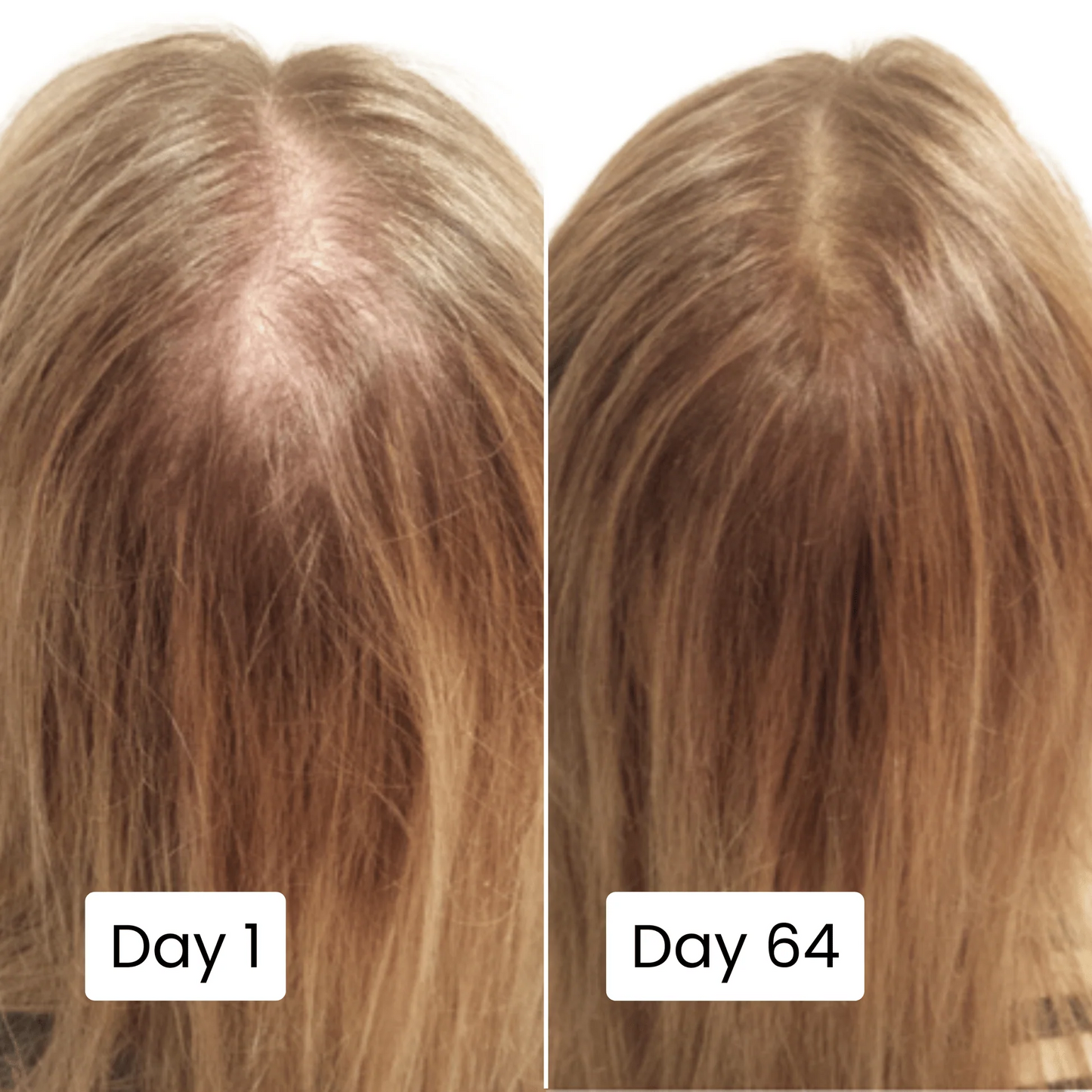Scalpy Hair Growth Serum | سيروم سكالبي