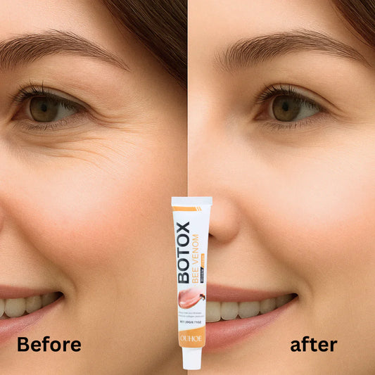 Botox Bee Venom Wrinkle Removal & Firming, Moisturizing, Lifting, Anti-Aging & Recovery for All Skin Type.