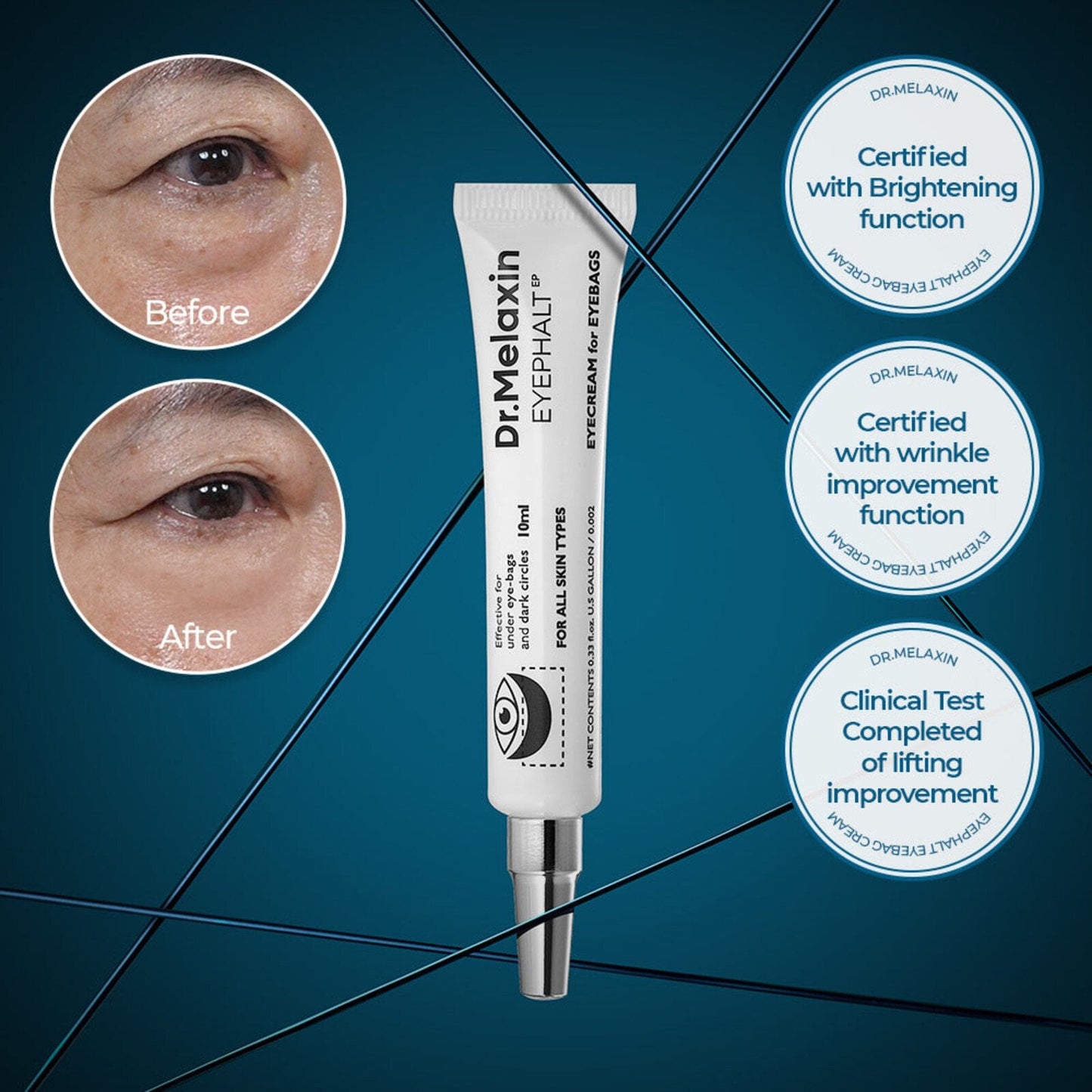 Dr. Melaxin Eyephalt EP 10g — Instant Eye-Lift & Dark Circle Recovery | دكتور ميلاكسين: شد فوري لمحيط العين وعلاج الهالات
