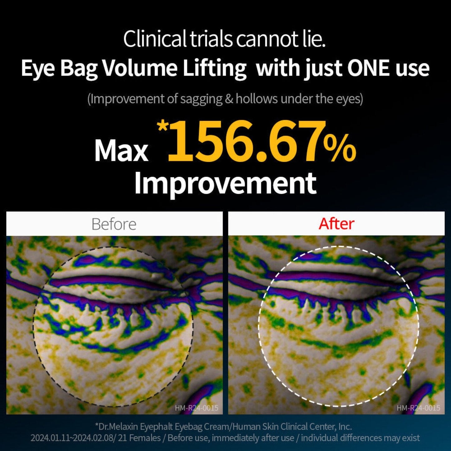 Dr. Melaxin Eyephalt EP 10g — Instant Eye-Lift & Dark Circle Recovery | دكتور ميلاكسين: شد فوري لمحيط العين وعلاج الهالات
