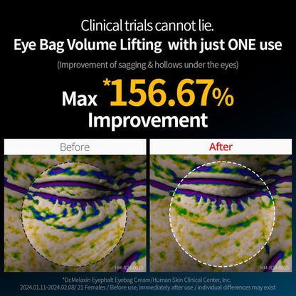 Dr. Melaxin Eyephalt EP 10g — Instant Eye-Lift & Dark Circle Recovery | دكتور ميلاكسين: شد فوري لمحيط العين وعلاج الهالات