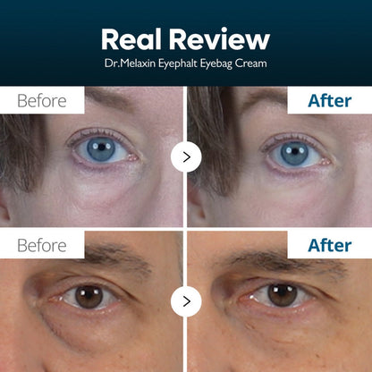Dr. Melaxin Eyephalt EP 10g — Instant Eye-Lift & Dark Circle Recovery | دكتور ميلاكسين: شد فوري لمحيط العين وعلاج الهالات