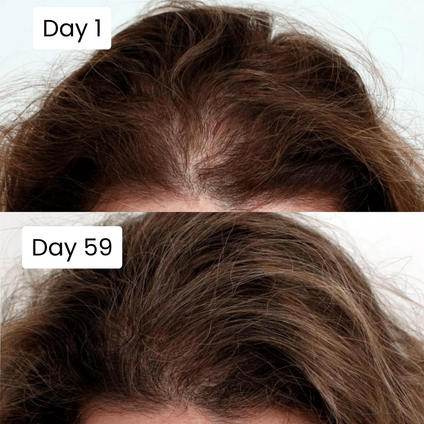Scalpy Hair Growth Serum | سيروم سكالبي