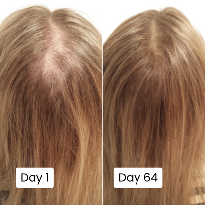 Scalpy Hair Growth Serum | سيروم سكالبي